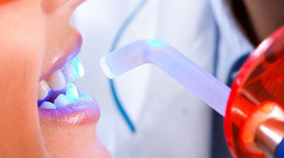 Отбеливание зубов лазером